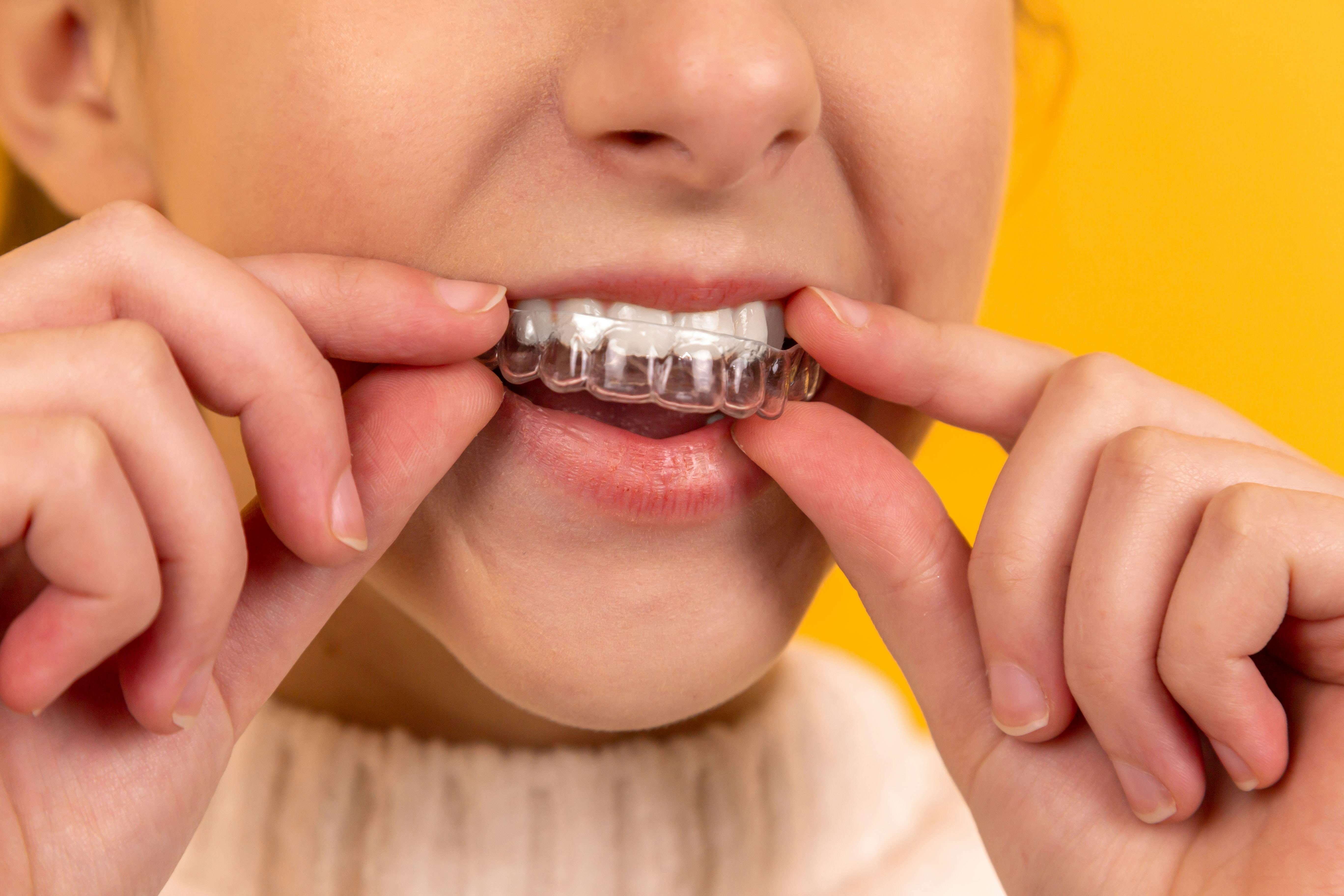 Dental equipment financing